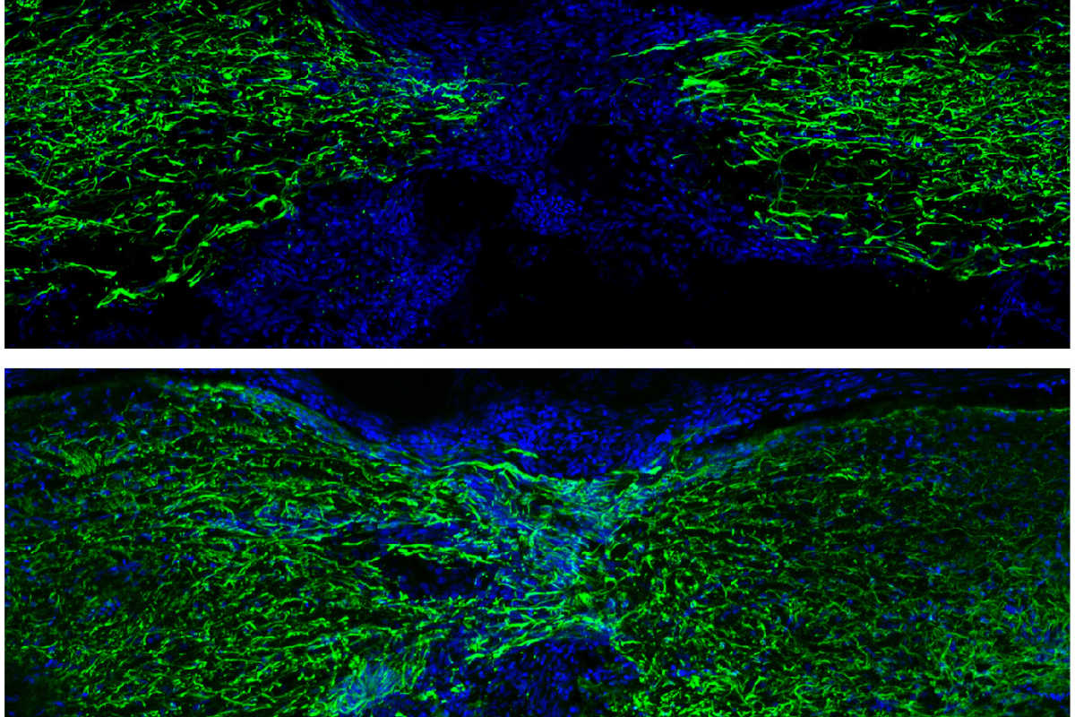 The image shows spinal cord regeneration in zebrafish one week (top) and four weeks (bottom) after injury (glial Gfap staining in green and nuclei in blue).