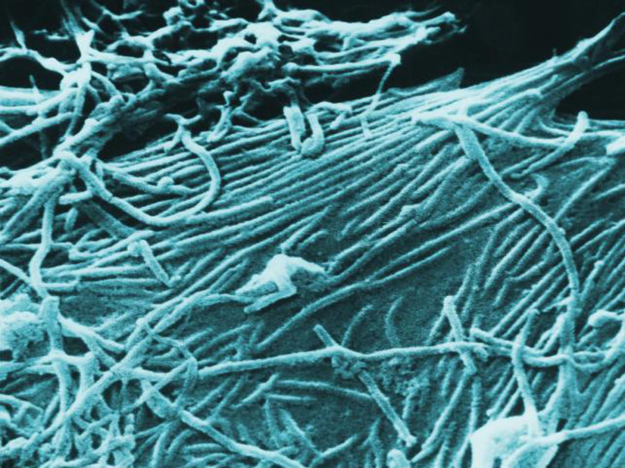 First discovered in 1976 in central Africa, Ebola is an infectious virus that can cause severe, often fatal illness in humans. Image courtesy of the Centers for Disease Control and Prevention / Cynthia Goldsmith.