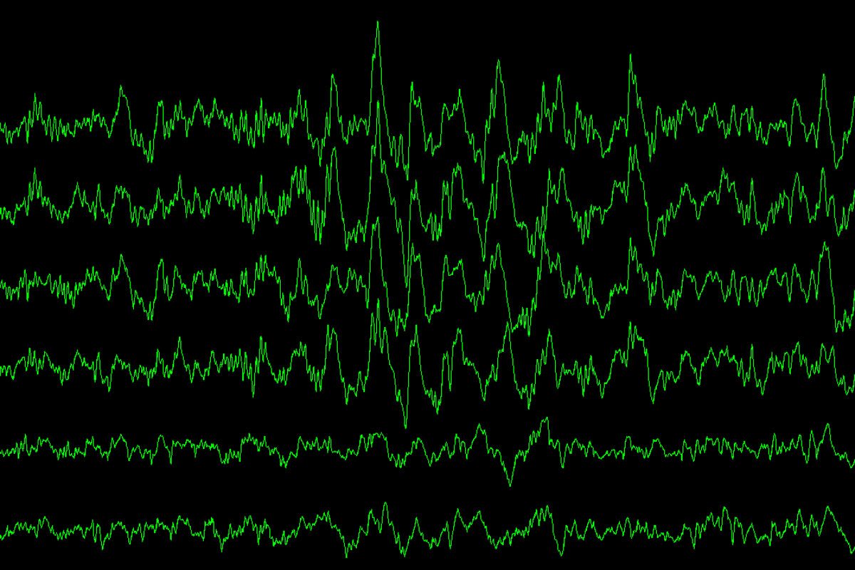 Shown are brain waves during slow-wave sleep, measured as a study participant slept. 