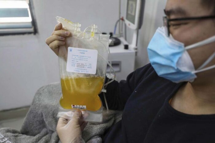 In this Feb. 18, 2020, file photo, Dr. Zhou Min, a recovered COVID-19 patient who has passed his 14-day quarantine, donates plasma in the city's blood center in Wuhan in central China's Hubei province. Plasma from recovered COVID-19 patients contains antibodies that may help reduce the viral load in patients that are fighting the disease.