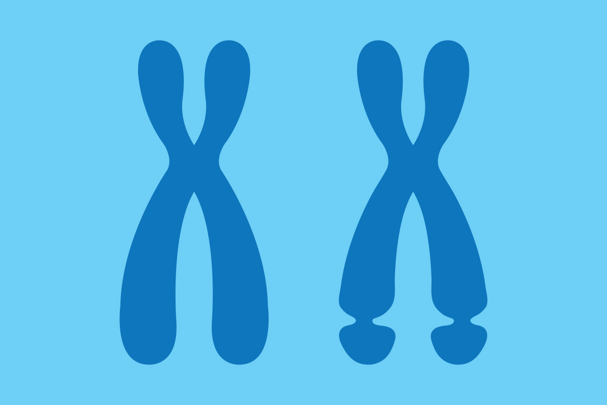 fragile x syndrome chromosome