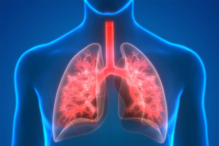 can you be misdiagnosed for copd