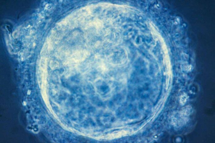 A several-days-old human embryo