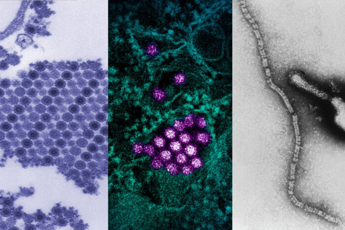 Micrographs of chikungunya, dengue and parainfluenza virus particles